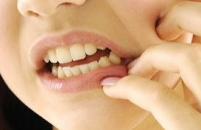 突發(fā)性、自發(fā)性的劇烈牙疼