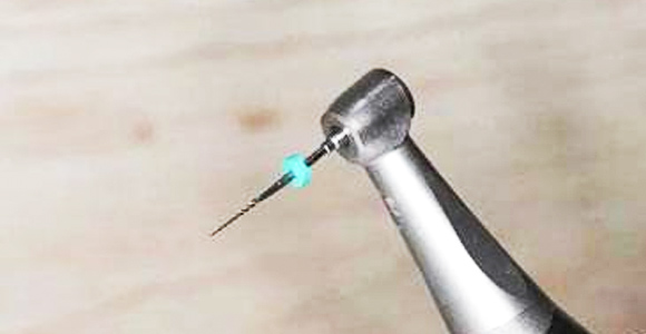 精細切割，極大程度保留牙神經(jīng)，根管治療成功率極高