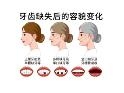 【科學(xué)科普】十個(gè)常用的口腔小知識(shí)！