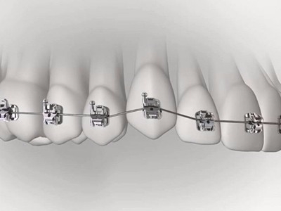 承德市哪家口腔醫(yī)院口腔正畸做得好？惟德口腔醫(yī)院來告訴您