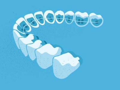 惟德口腔醫(yī)院口腔正畸好不好？